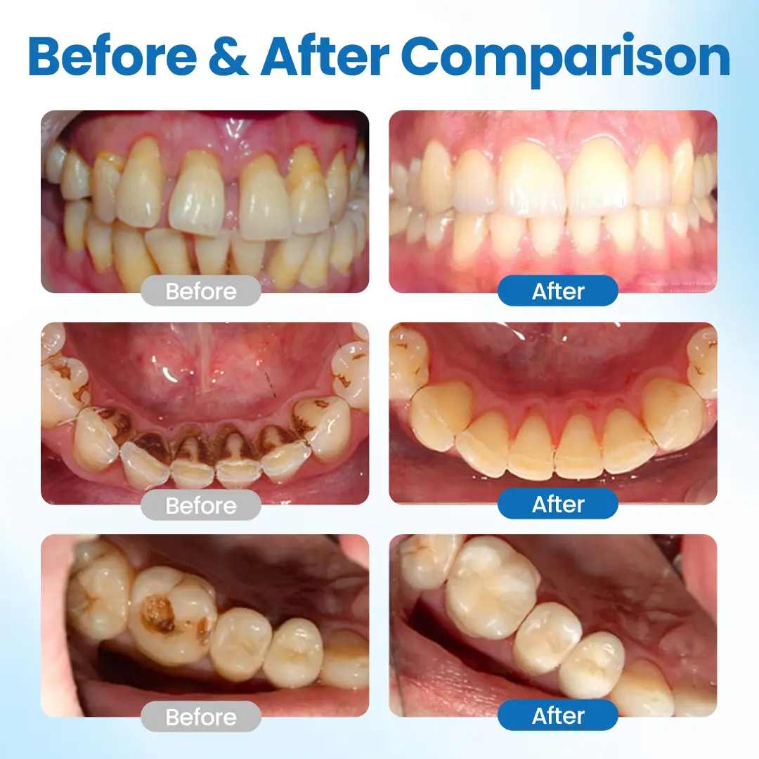 NanoHAP Tooth Defense Serum - Image 2