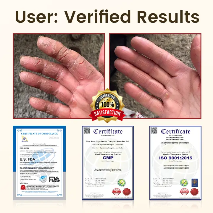 DiaRelief Healing Cream - Image 3