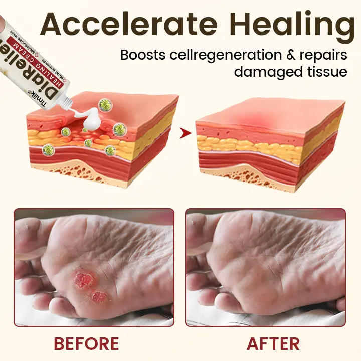 DiaRelief Healing Cream - Image 4