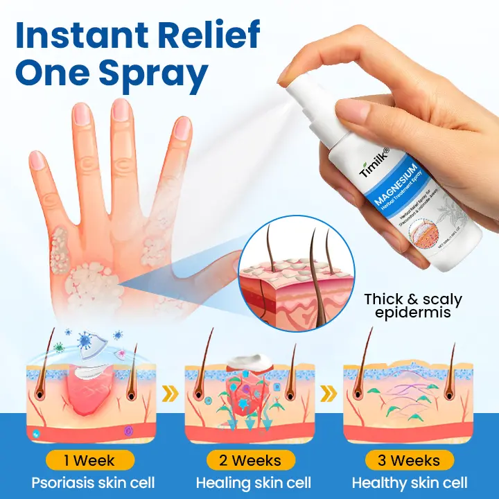 Magnesium Herbal Treatment Spray - Image 8