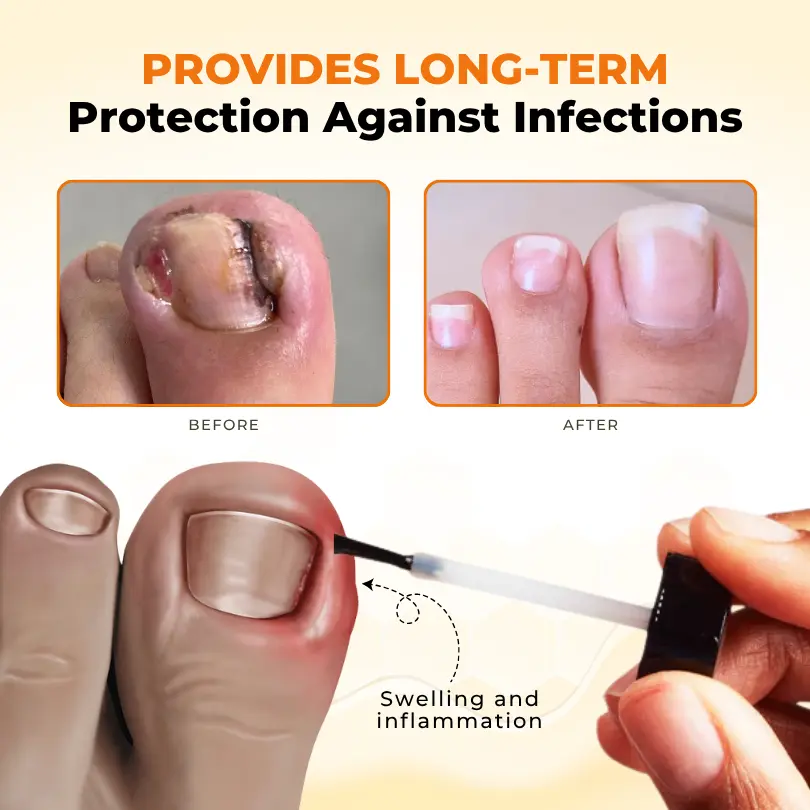 NailRevive Bee Venom Anti-fungi Solution - Image 5