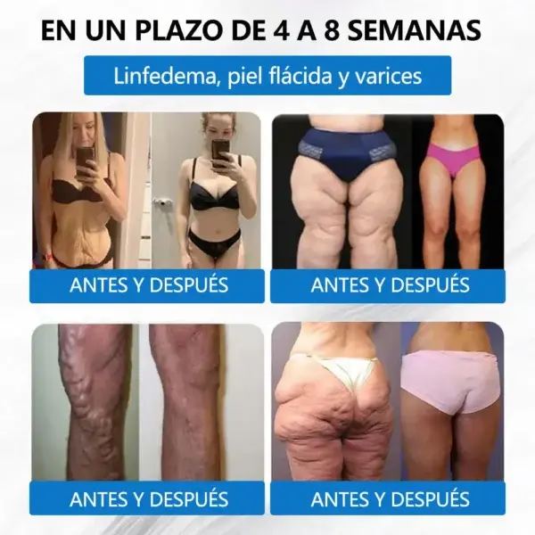 𝟑𝟎-𝐞𝐧-𝟏 𝐁𝐞𝐫𝐛𝐞𝐫𝐢𝐧𝐞 · 𝐍𝐀𝐃+/𝐍𝐌𝐍 × 𝐌𝐚𝐭𝐫𝐢𝐱𝐲𝐥 𝟑𝟎𝟎𝟎 𝐀𝐝𝐯𝐚𝐧𝐜𝐞𝐝 𝐋𝐢𝐩𝐨𝐬𝐨𝐦𝐚𝐥 𝐏𝐚tch - Image 4