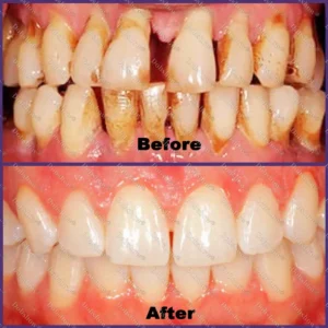 Alternative view of 🐝 ApiCore BeeVenom Vital Repair Toothpaste