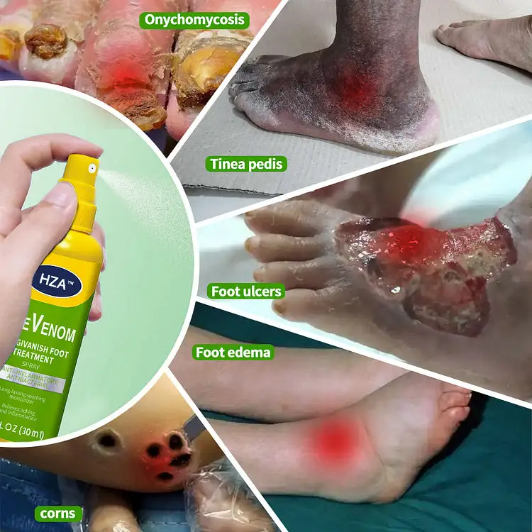 FungiVanish Foot Treatment Spray - Image 9