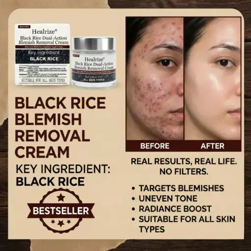 Black Rice Dual-Action Blemish Removal Cream - Image 2