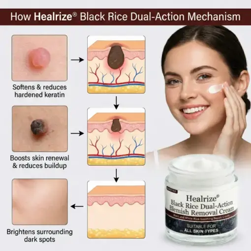Black Rice Dual-Action Blemish Removal Cream - Image 6