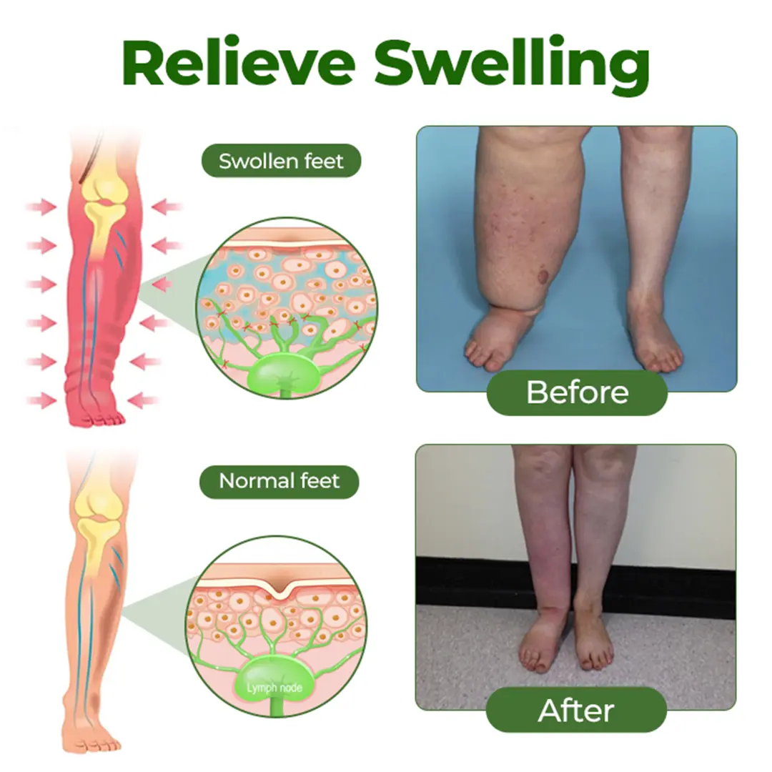 ๐ถ๐๐๐๐๐๐๐ ๐บ๐๐๐๐ Professional Leg Circulation Cream - Image 4