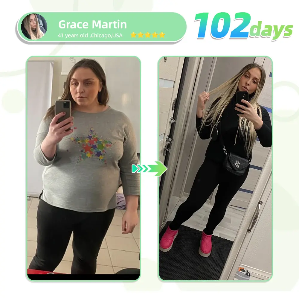 Matrixyl 3000 Nano Microneedle Patch - Image 14