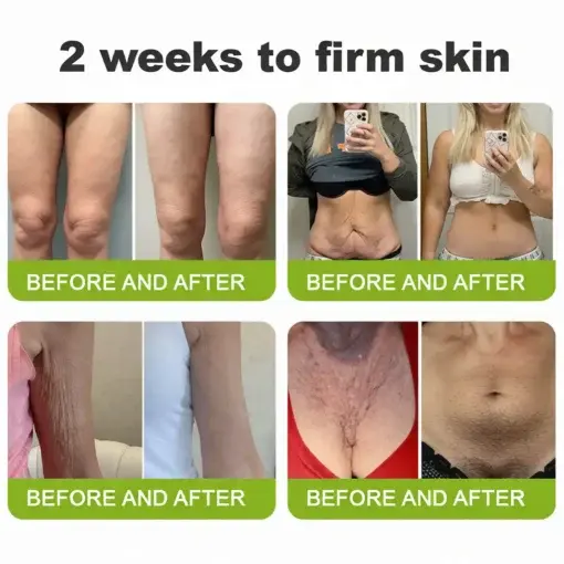 Botin Vita-A Retinol Shot Wrinkle-Lift Tightening cream – Last Day Promotion 70 OFF - Image 8