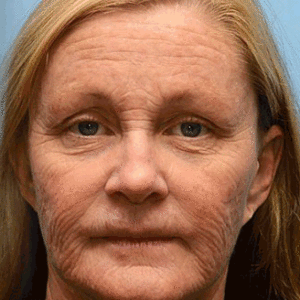 Alternative view of 👏🌿Made and shipped from the USA Botox & Vita-A Retinol Shot Wrinkle-Lift Tightening cream - Last Day Promotion 70% OFF