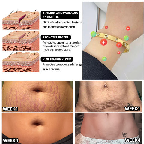 Lymphatic Magnetic Therapy Bracelet - Image 14