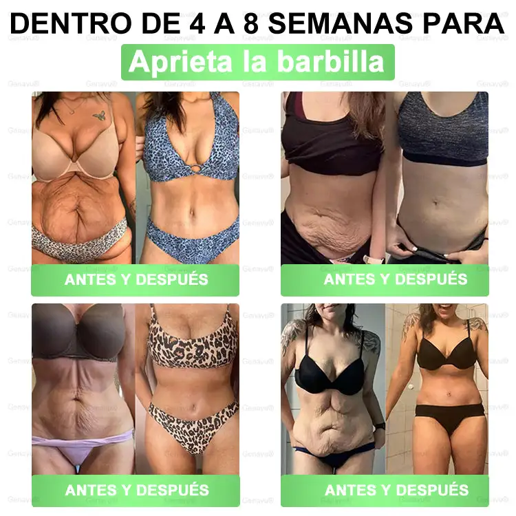 Parche de Microagujas Nano Avanzado 10 en 1 con Moringa, Berberina y NAD+ - Image 7