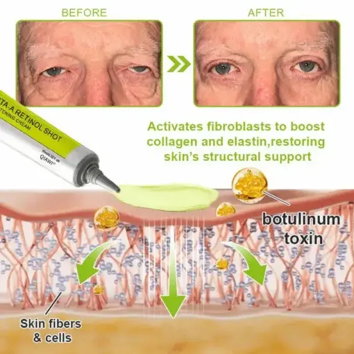 Advanced Peptide Botulinum-Style + Vita-A Retinol Lifting Renewal Cream - Image 5