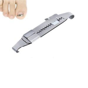 Alternative view of Toenails Correction Stainless Steel Clip Buckle