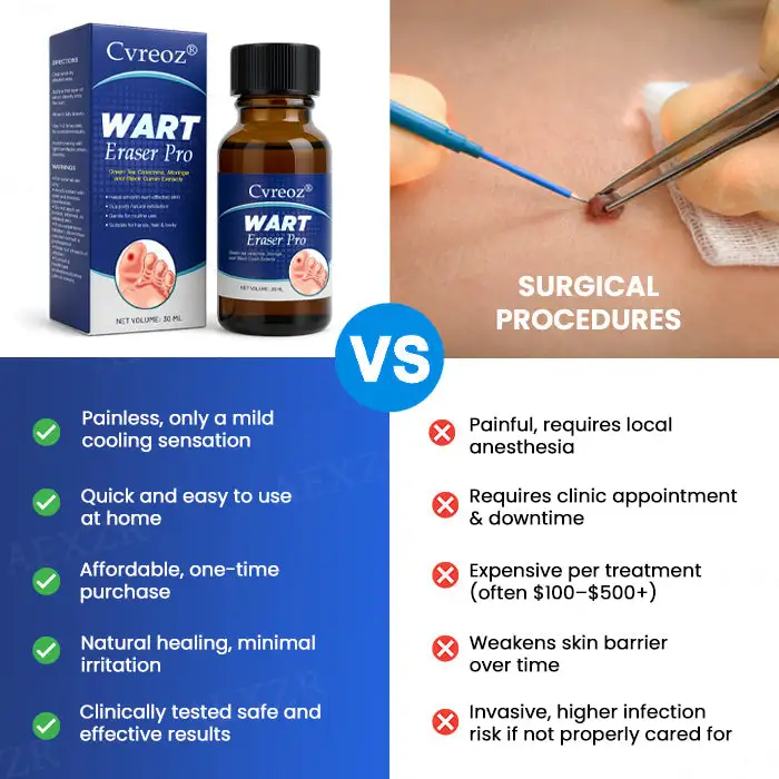 🔥Warts No More - 50% OFF | Wart Eraser Pro - Image 5