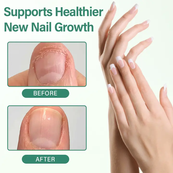 Nail Detox Penetration Serum Pen - Image 7