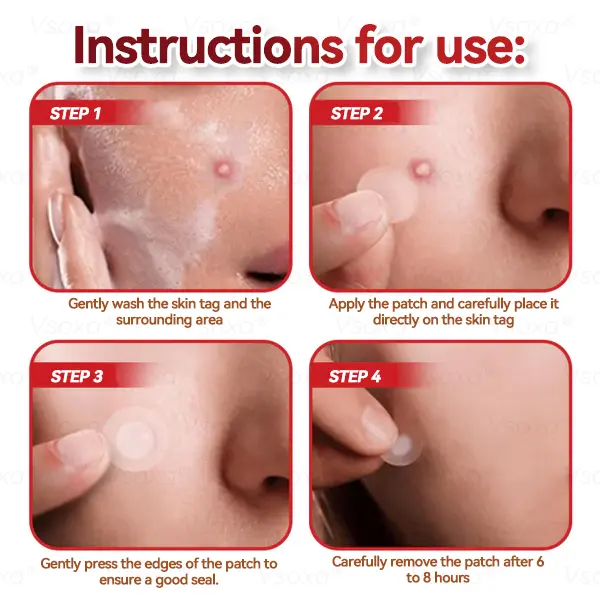Microneedles Botanical Skin Tags Solution Patches - Image 14