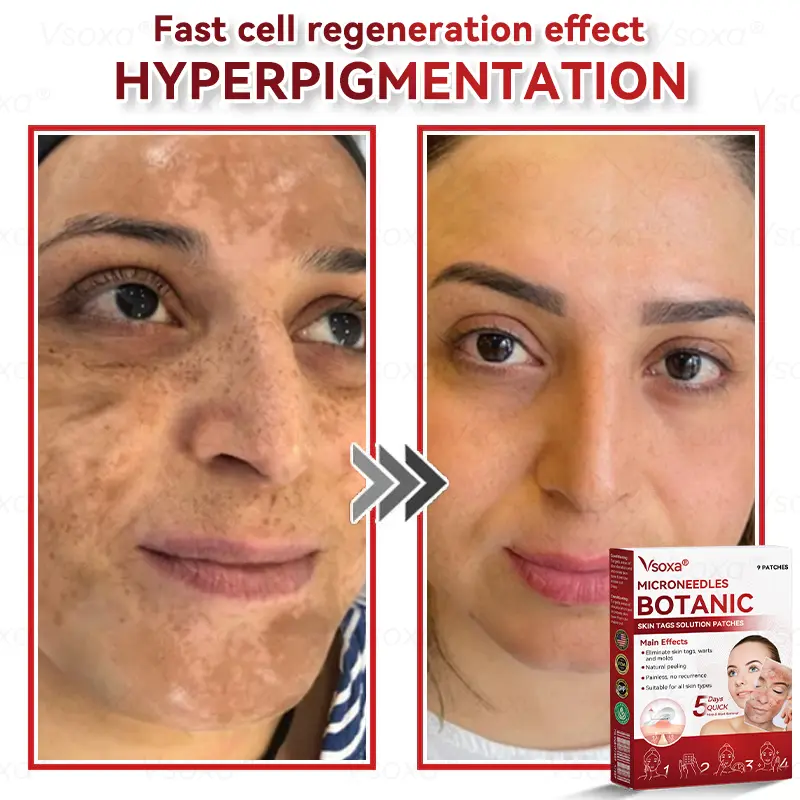 Microneedles Botanical Skin Tags Solution Patches - Image 7