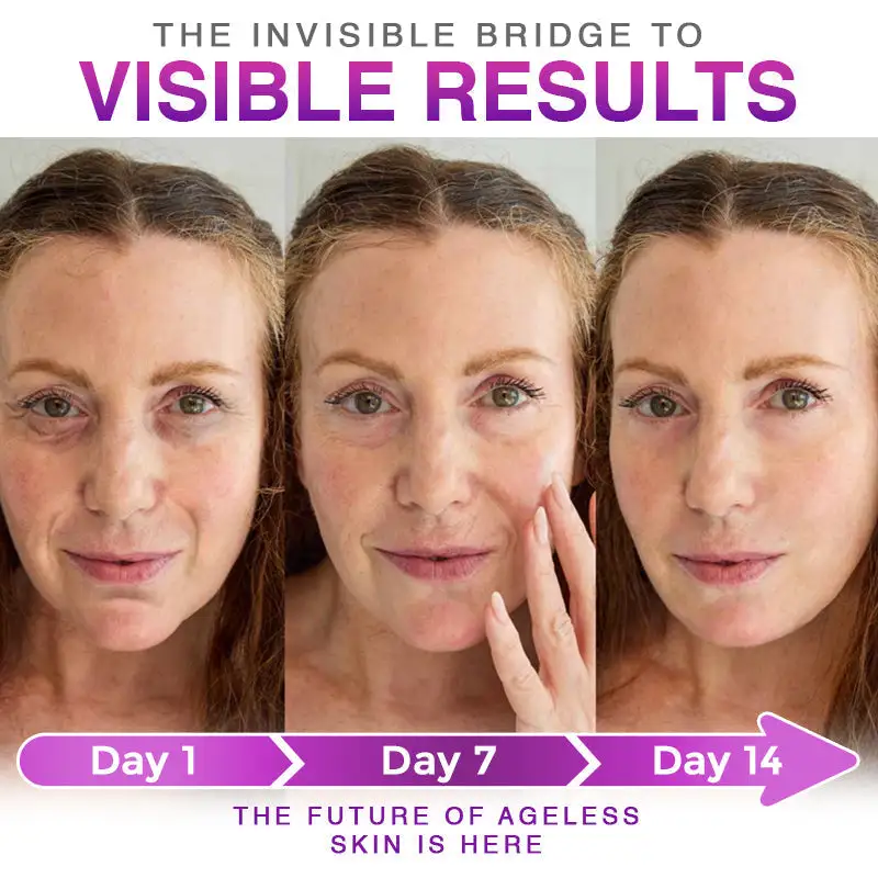 3-in-1 Microneedle Anti-Aging Patch - Image 7