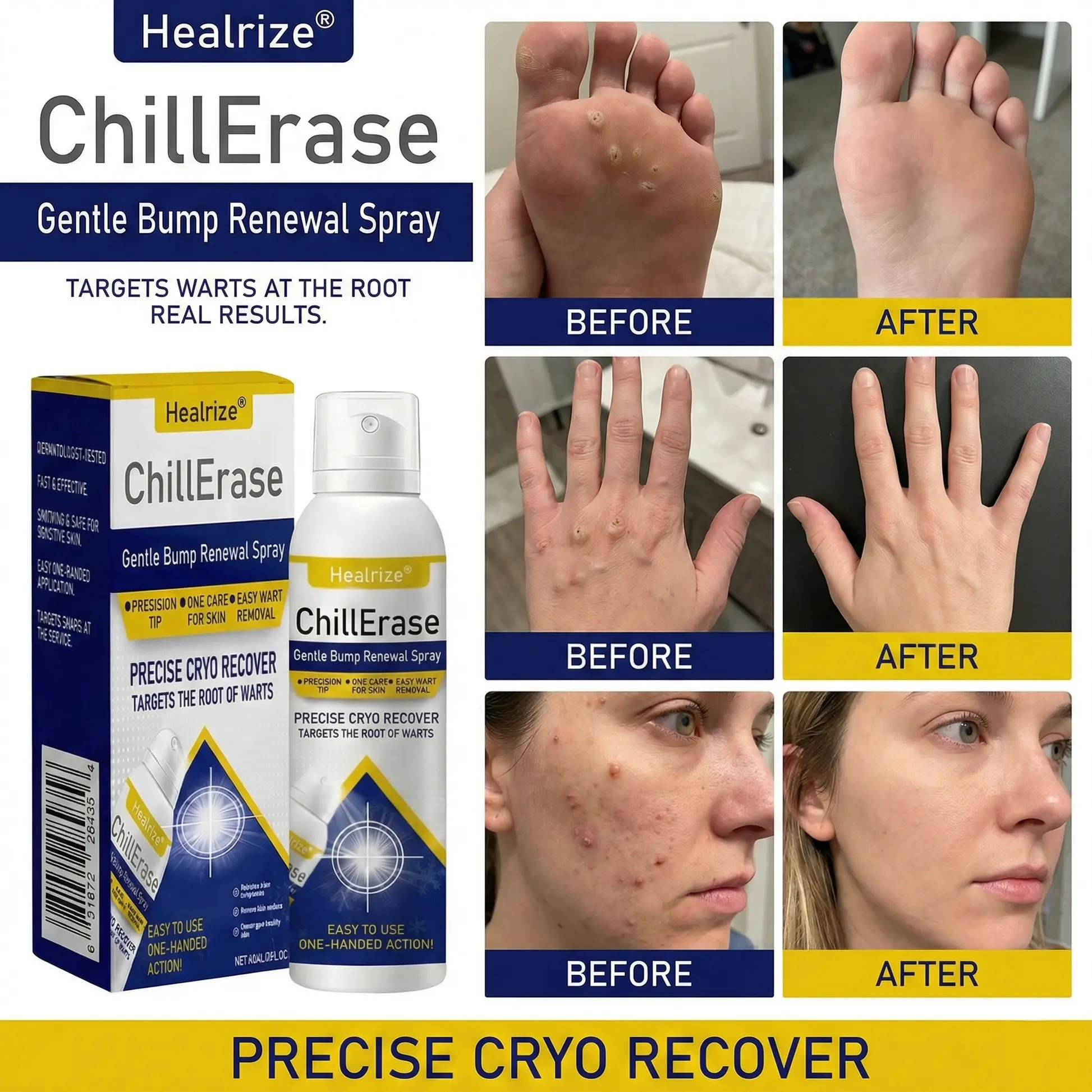 โ๏ธ๐๐ฅ๐๐๐๐๐ก ๐๐ง๐ค๐ข๐ค๐ฉ๐๐ค๐ฃ | ChillErase Gentle Bump Renewal Spray - Image 3