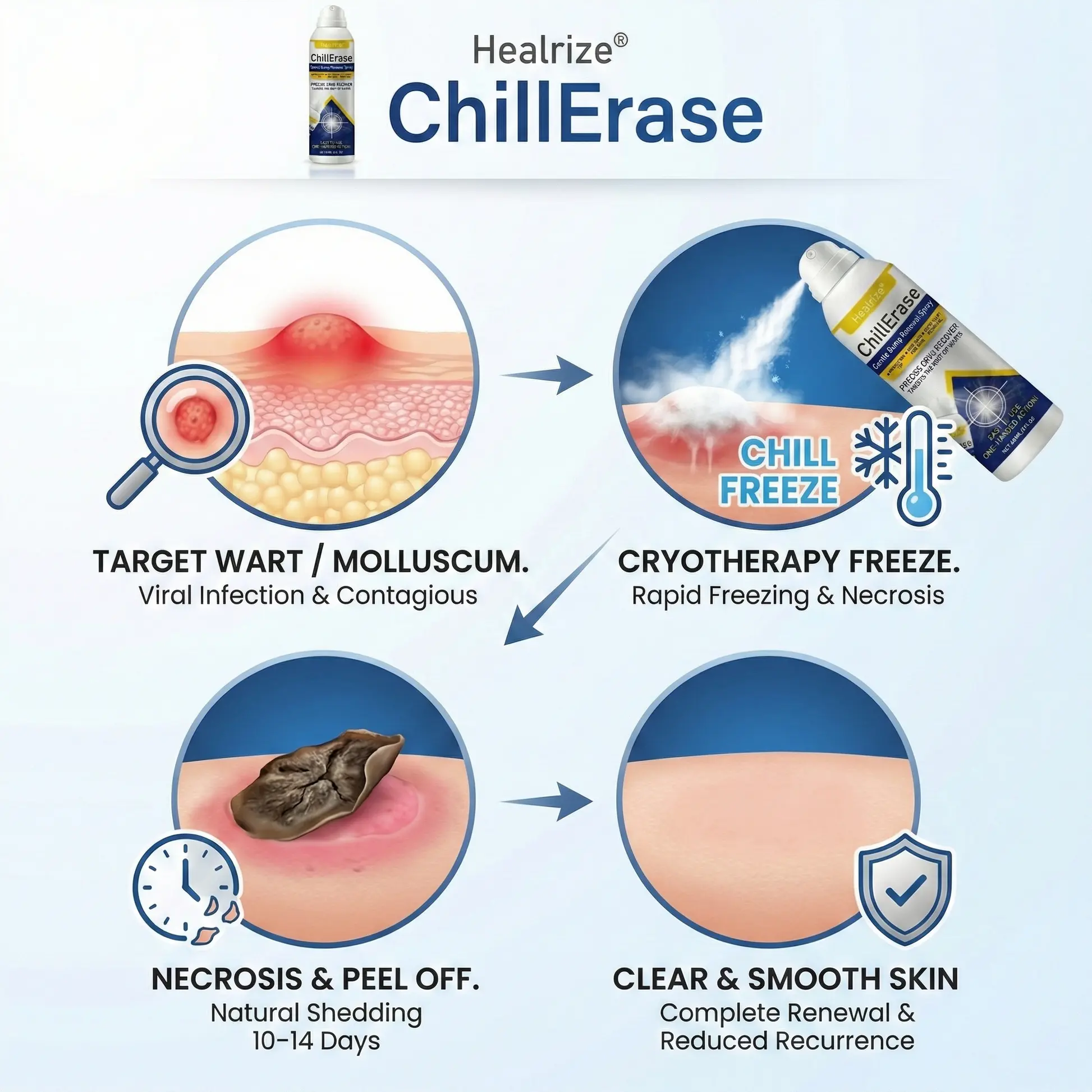 โ๏ธ๐๐ฅ๐๐๐๐๐ก ๐๐ง๐ค๐ข๐ค๐ฉ๐๐ค๐ฃ | ChillErase Gentle Bump Renewal Spray - Image 4