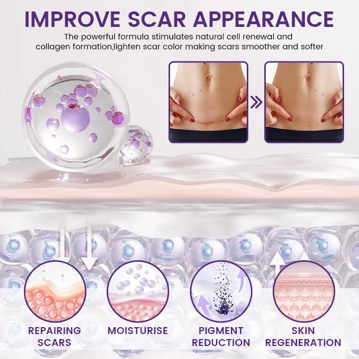 ReGenScar Stem Cell Repair Gel - Image 6