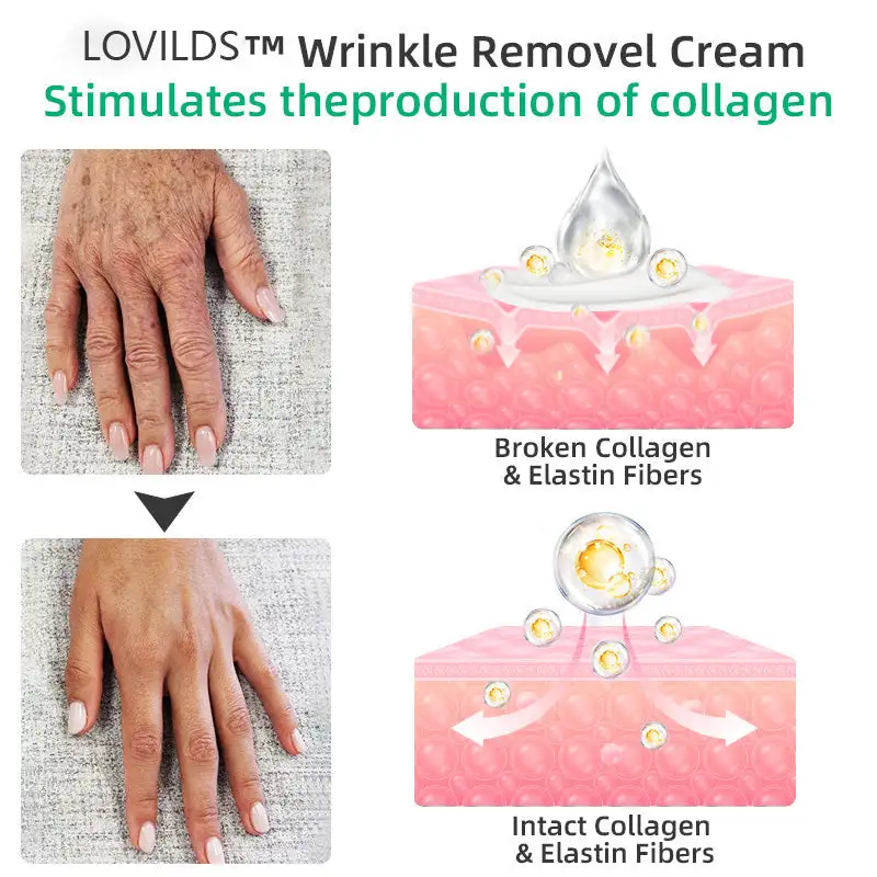 Wrinkle Removel Cream,Address Crepe & Sagging - Image 12