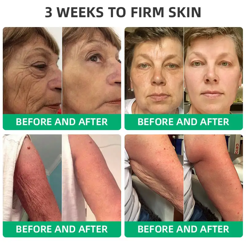 Wrinkle Removel Cream,Address Crepe & Sagging - Image 5