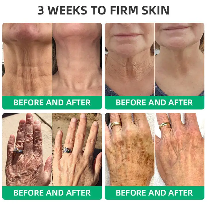 Wrinkle Removel Cream,Address Crepe & Sagging - Image 6