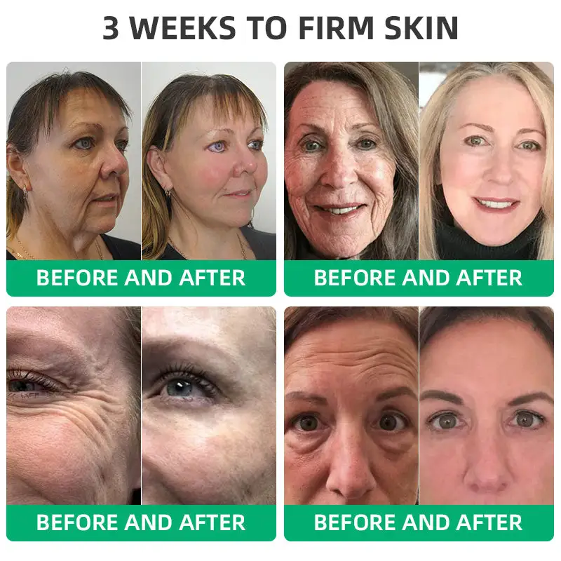 Wrinkle Removel Cream,Address Crepe & Sagging - Image 7
