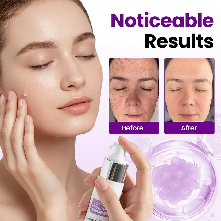 StainFade Facial Serum with Probiotics - Image 5