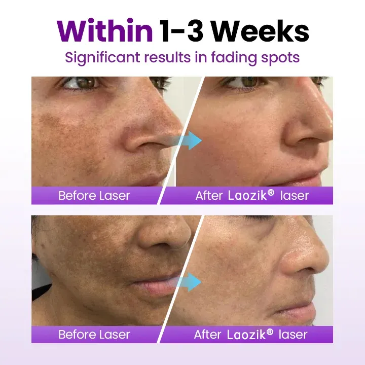 StainFade Facial Serum with Probiotics - Image 3
