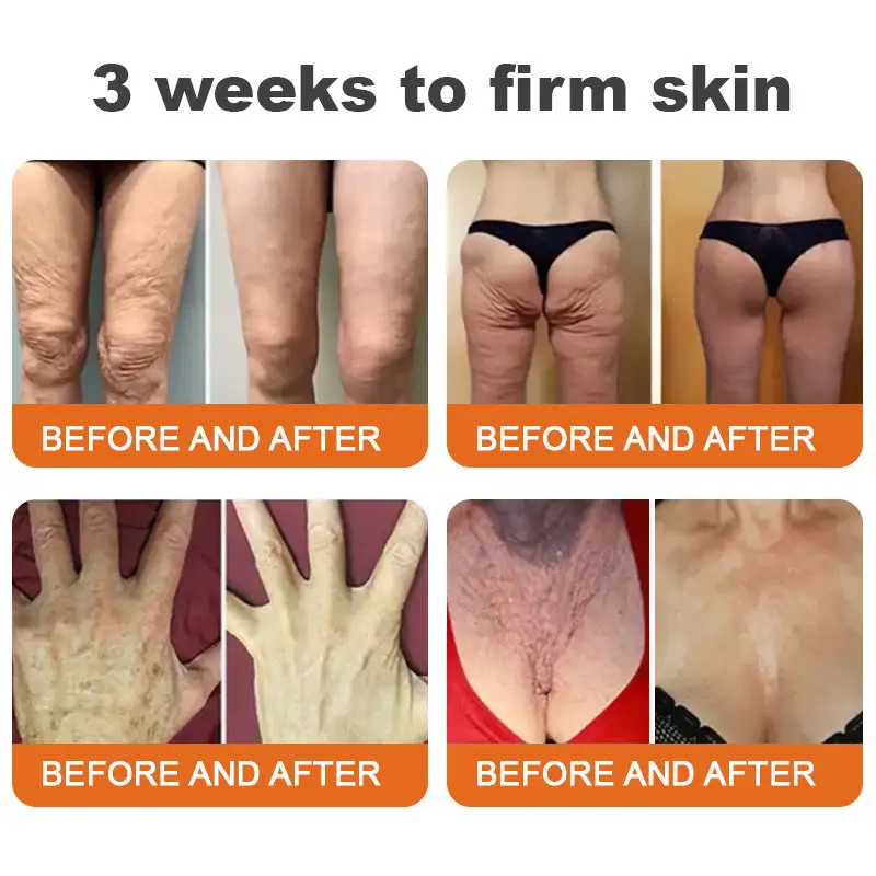 Made and Shipped from the Botox Bee Venom Firming Serum Stick LAST DAY 70% OFF - Image 3