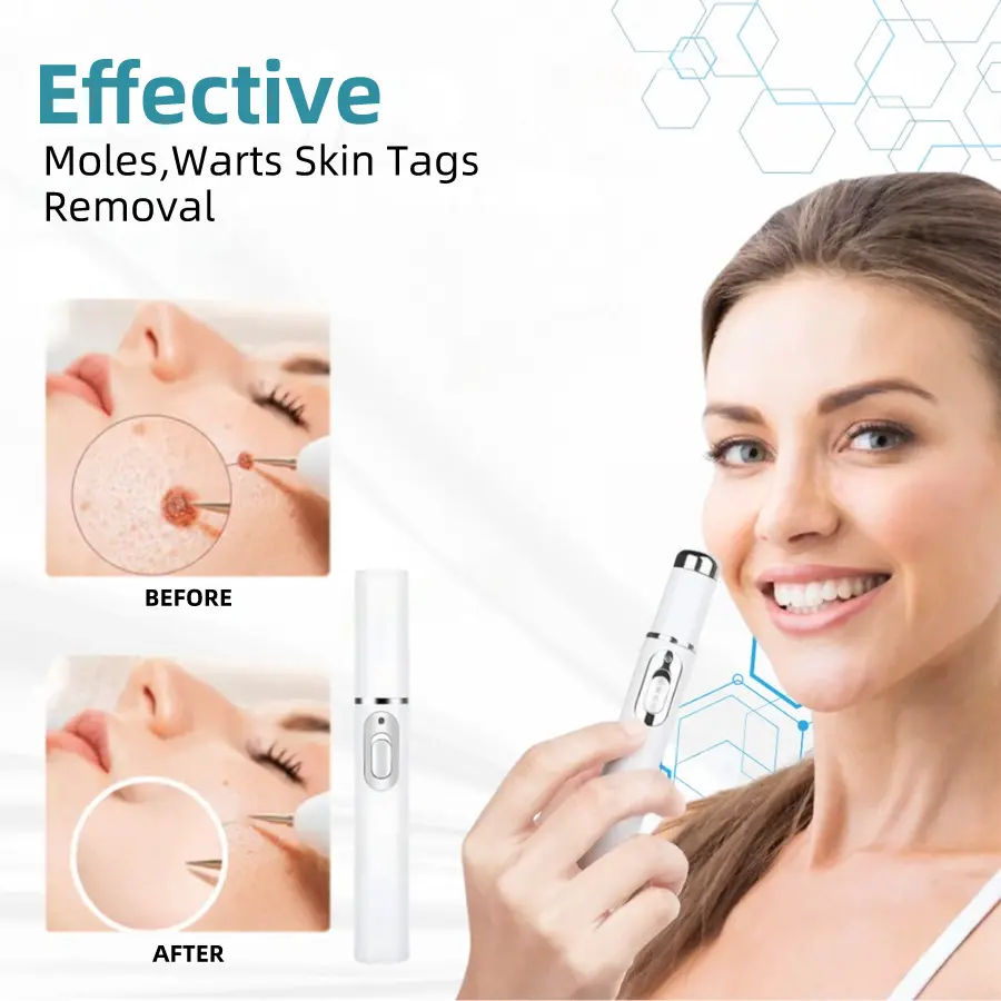 Medical-Grade Laser Pen - Image 4