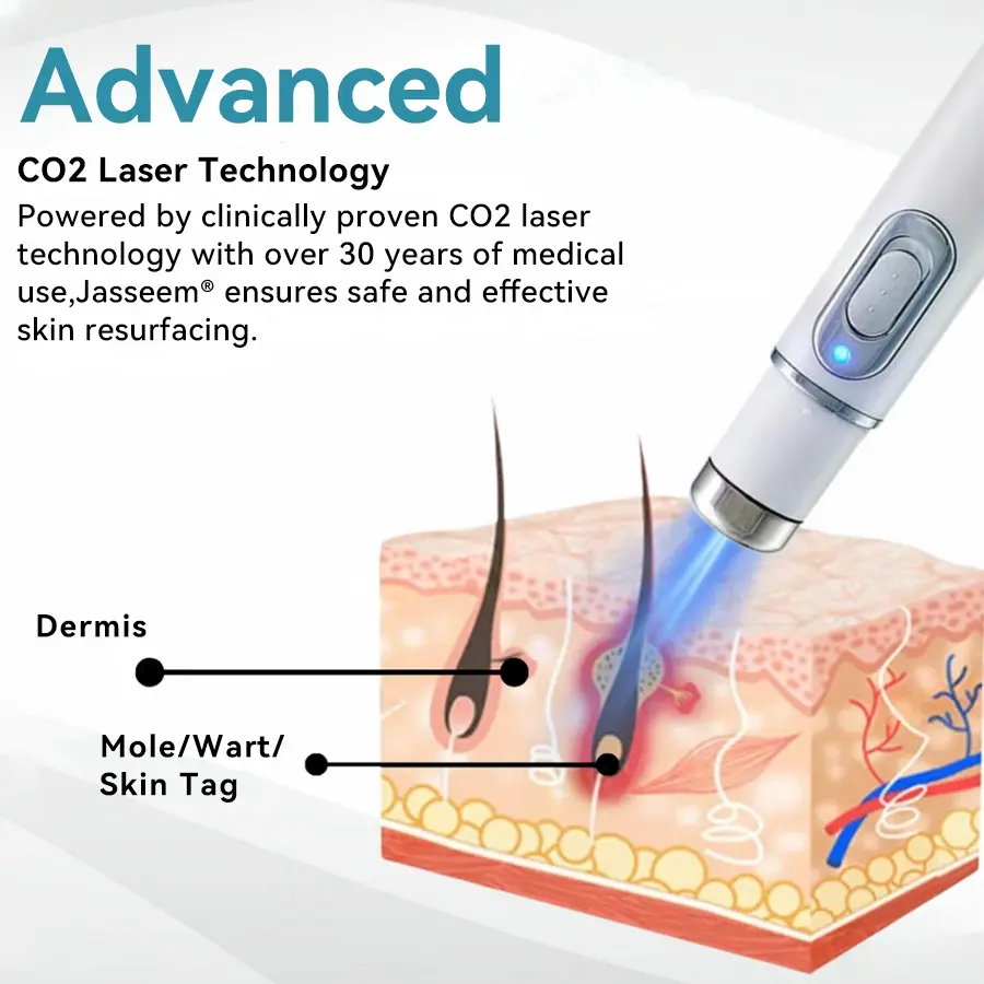 Medical-Grade Laser Pen - Image 6