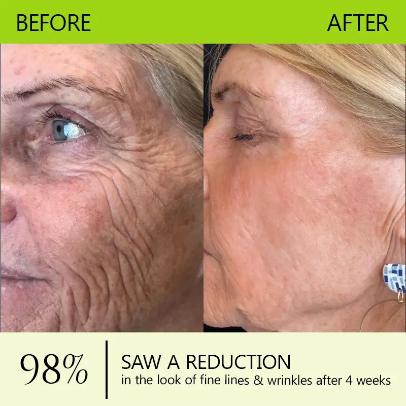 BOTOX & VITA A RETINOL SHOT Wrinkle Lift Tightening Cream - Image 11