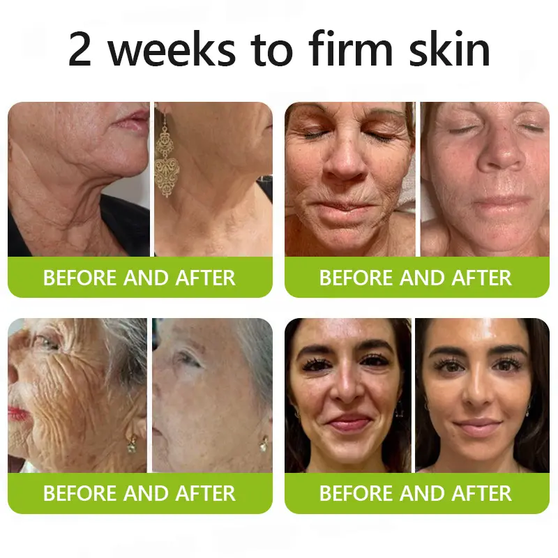 BOTOX & VITA A RETINOL SHOT Wrinkle Lift Tightening Cream - Image 4