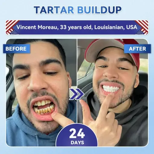 Tideglusib Fast‑Dissolving Tooth & Gum Repair Oral Strips - Image 13