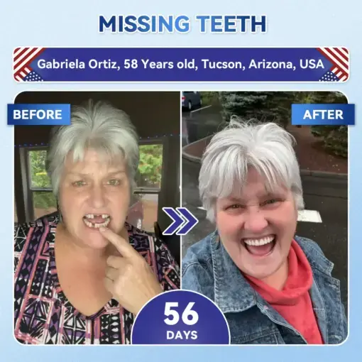 Tideglusib Fast‑Dissolving Tooth & Gum Repair Oral Strips - Image 3