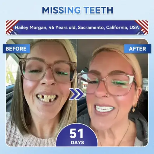 Tideglusib Fast‑Dissolving Tooth & Gum Repair Oral Strips - Image 4