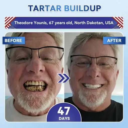 Tideglusib Fast‑Dissolving Tooth & Gum Repair Oral Strips - Image 5