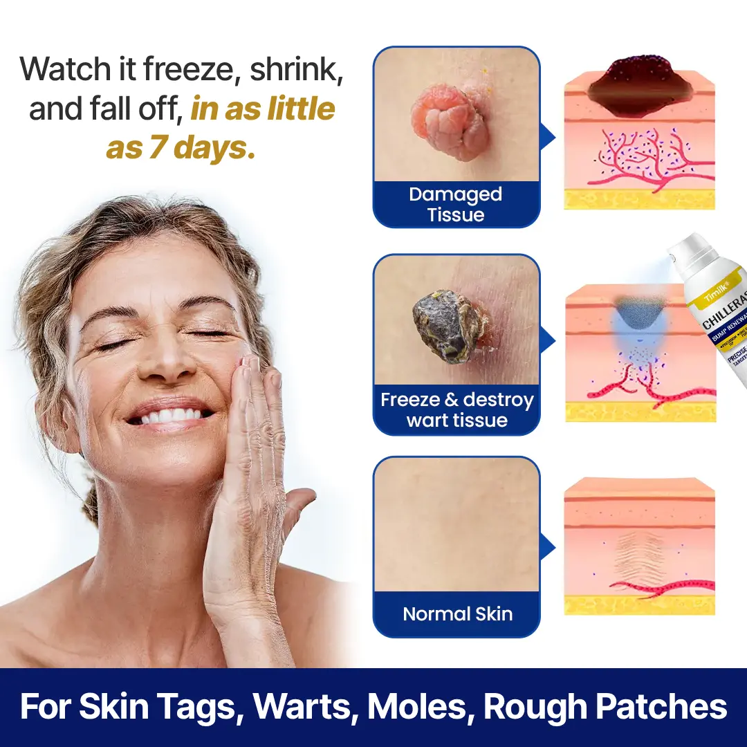 Timilk Bump Renewal Spray - Image 7