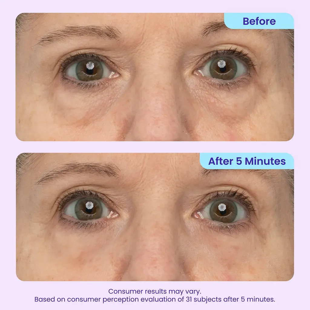 Instant Lift Eye Gel - Image 5
