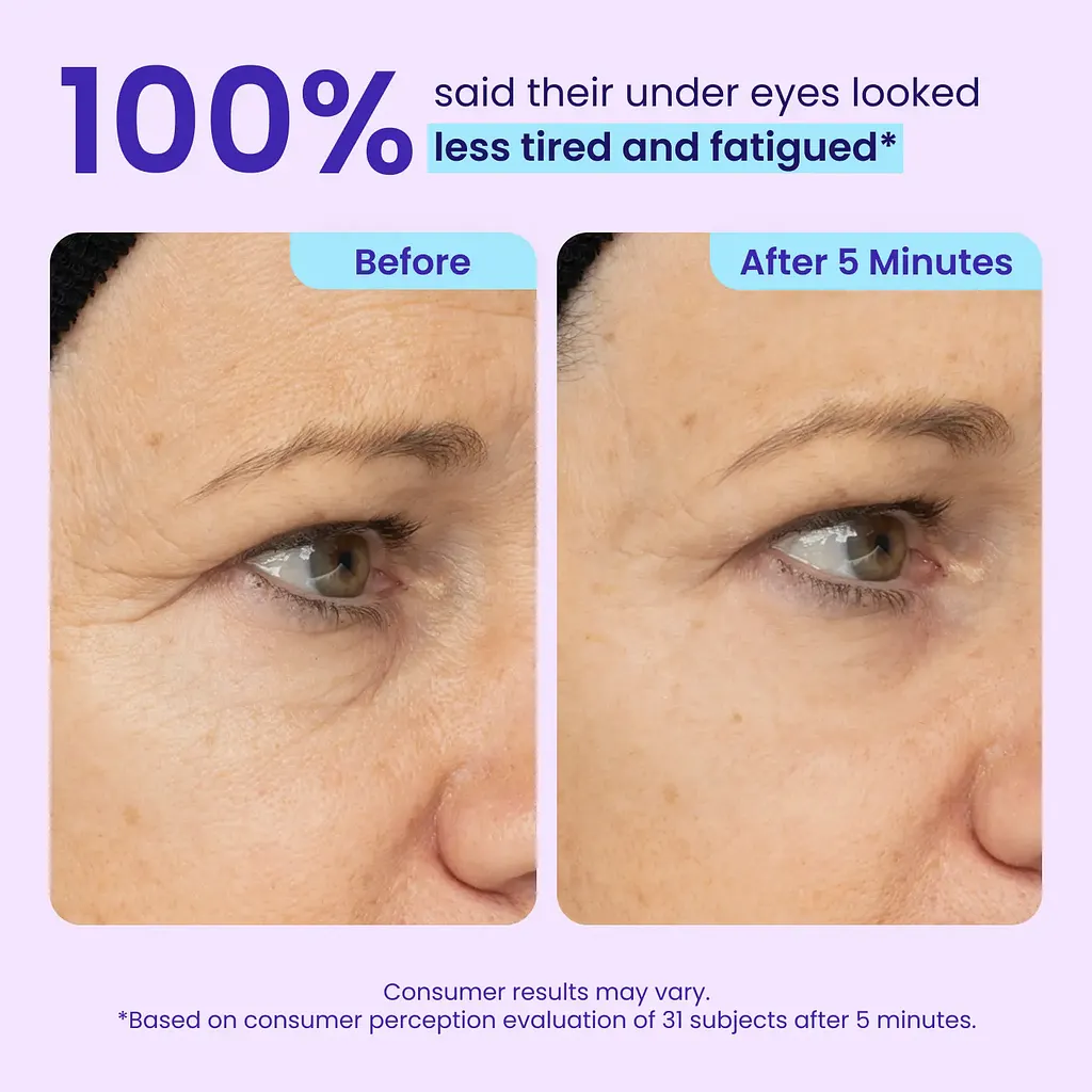 Instant Lift Eye Gel - Image 4