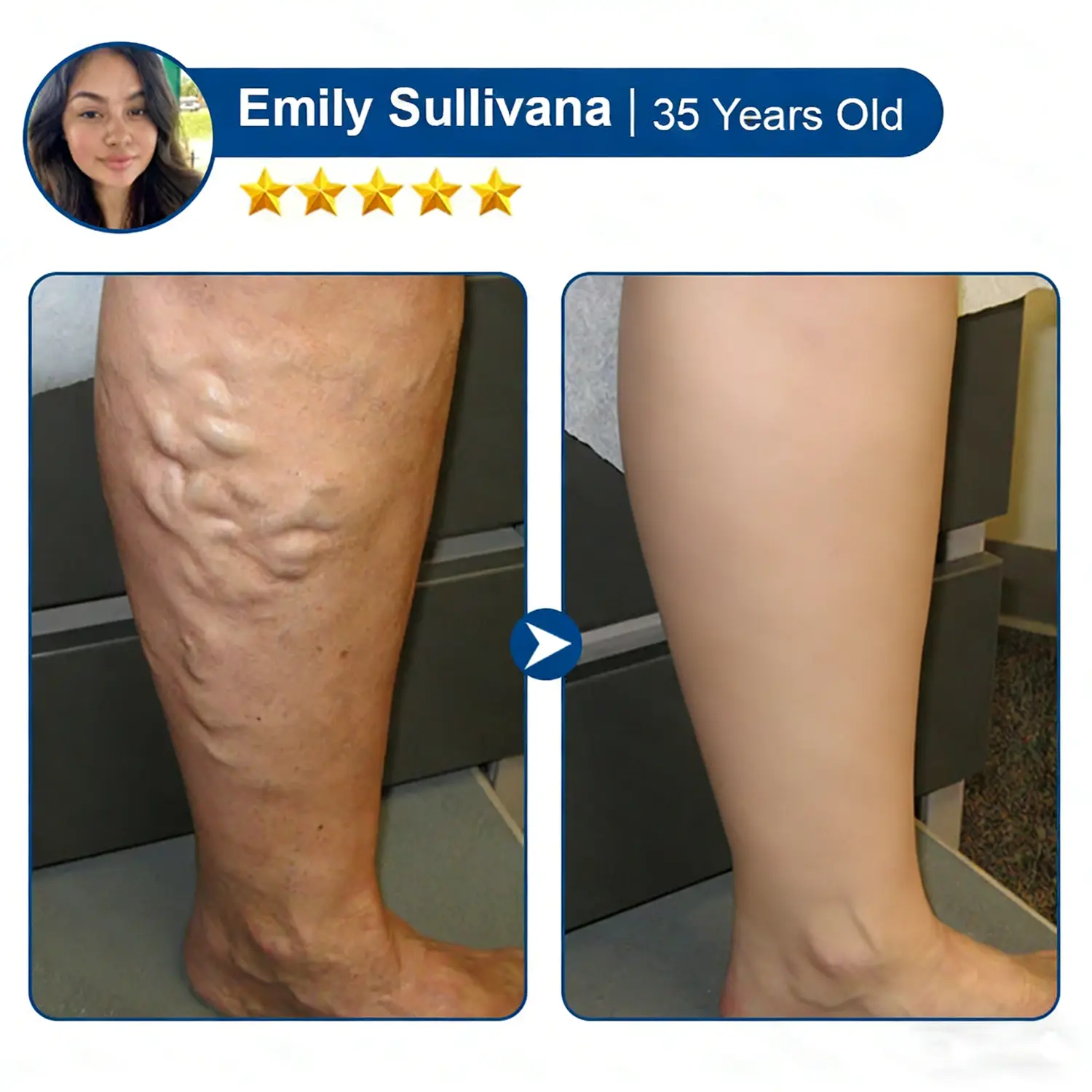 Skip Costly Procedures — Find Relief With One Easy Patch! - Image 13