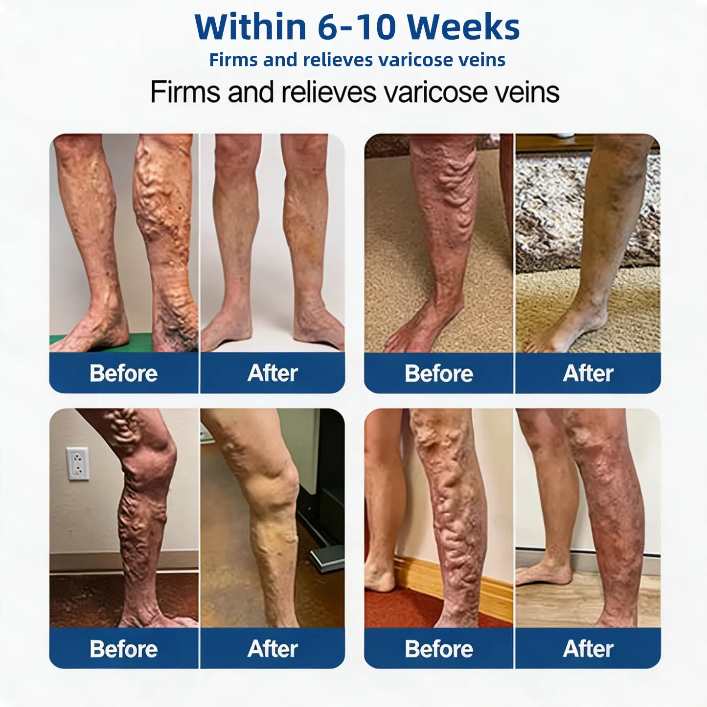 Vein Relief Patch - Image 6