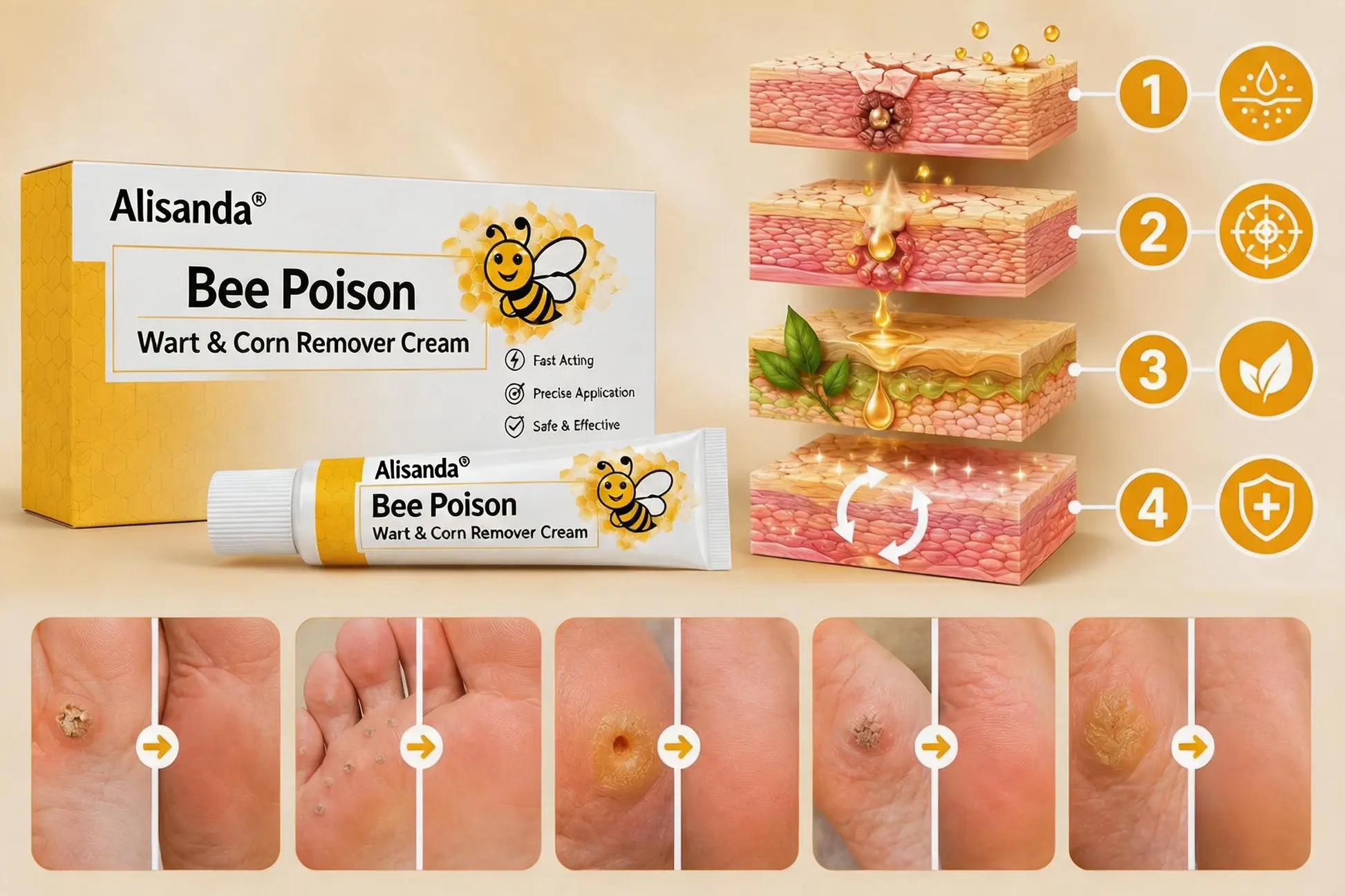 Bee Poison Wart & Corn Remover Cream - Image 6
