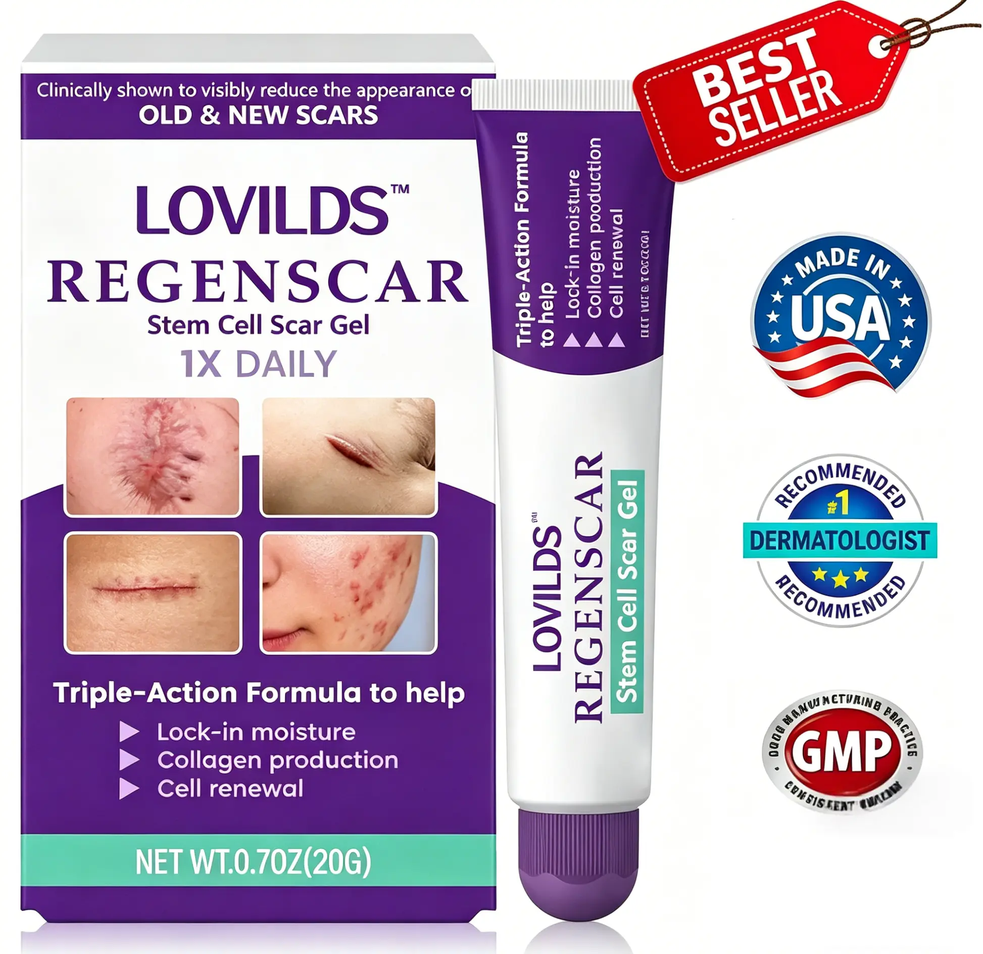 ReGenScar Stem Cell Repair Gel