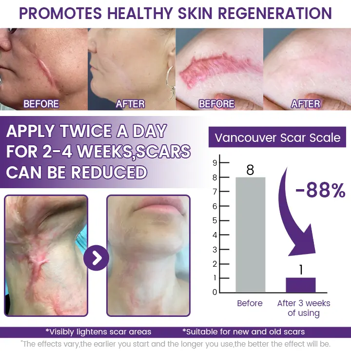 ReGenScar Stem Cell Repair Gel - Image 3