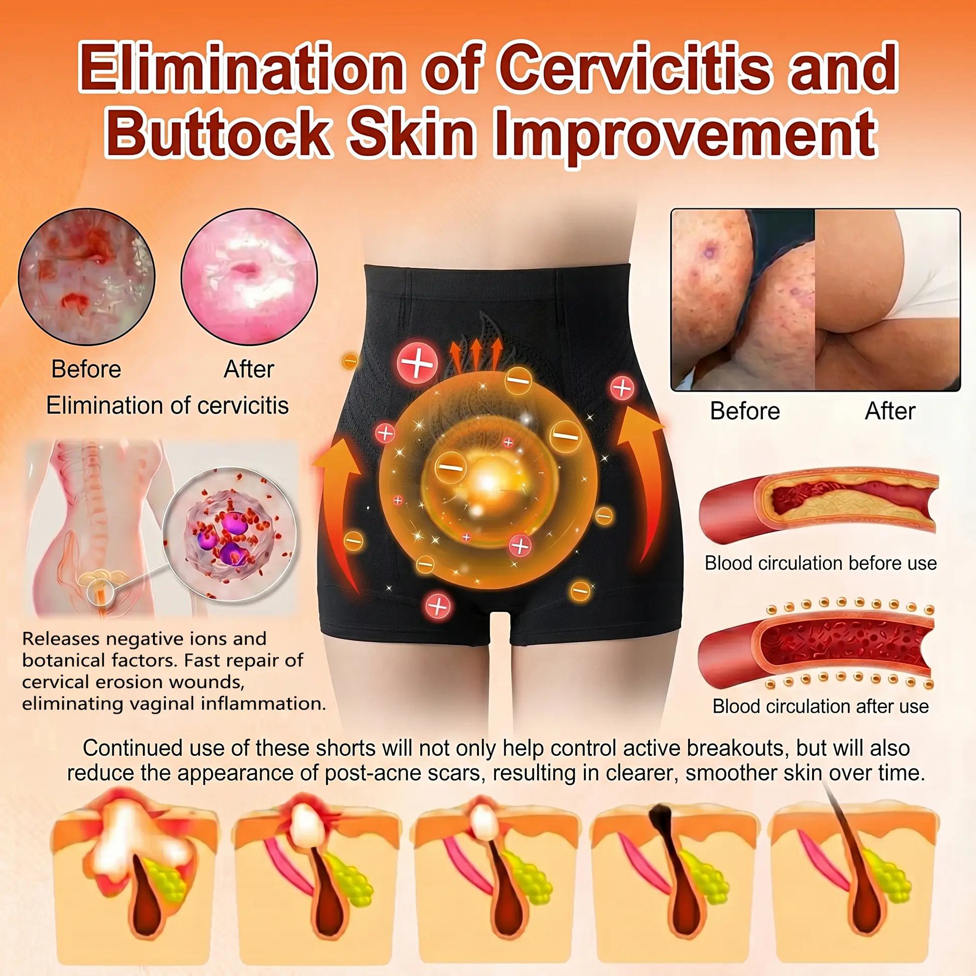 30-Min All-in-One Micro-Particle Fat-Burning Shorts - Image 13